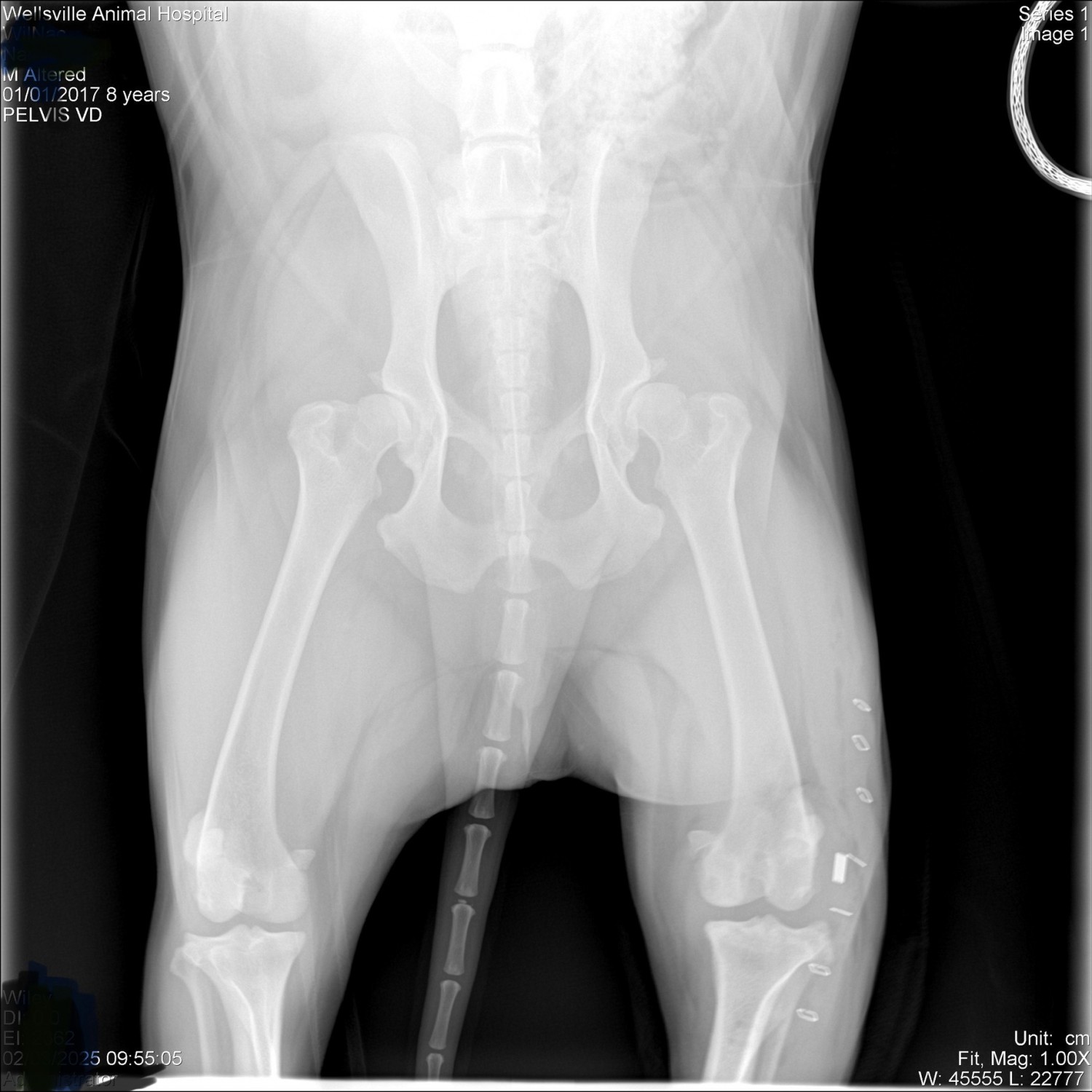 Hip Dysplasia 